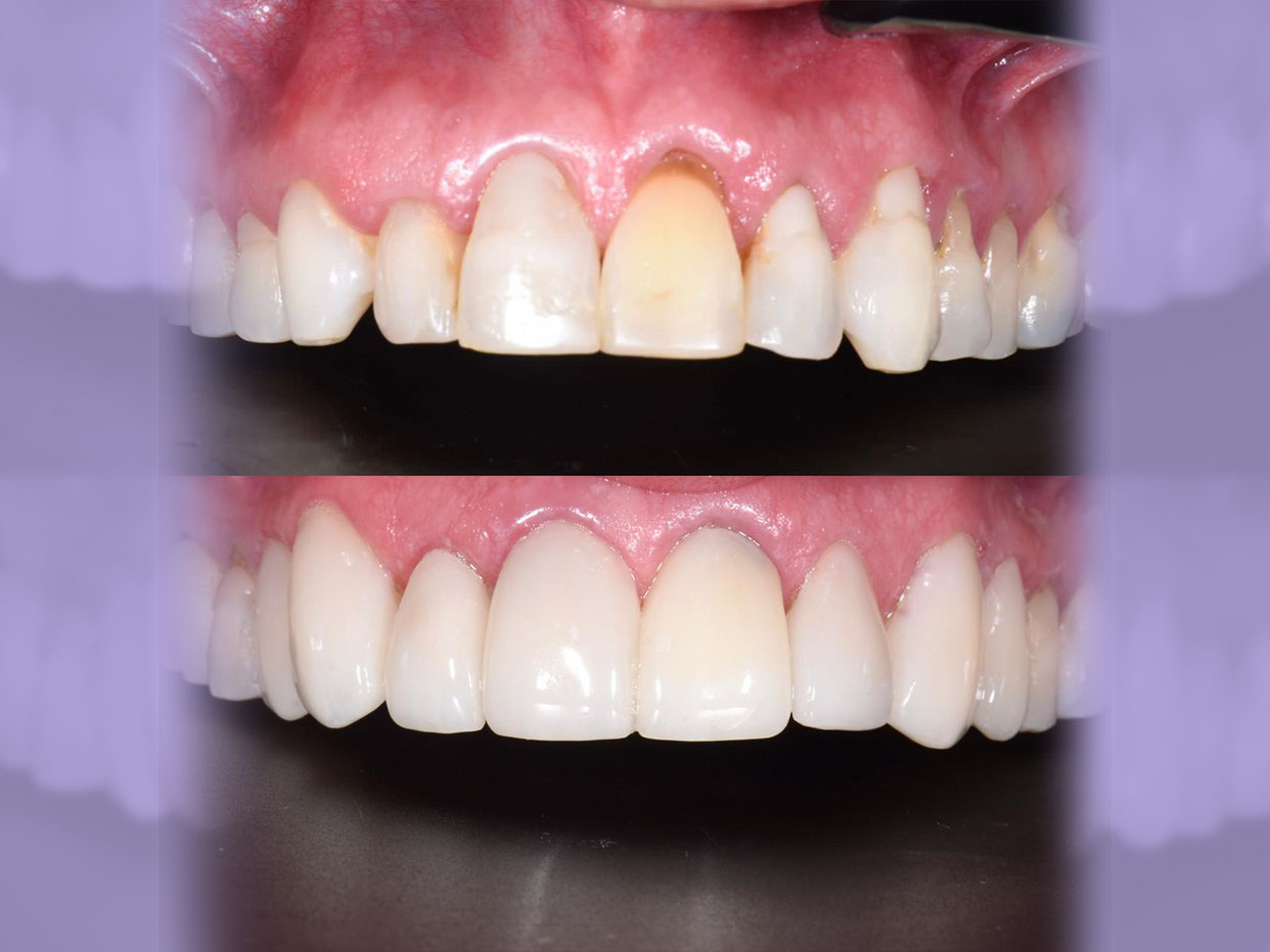 Sin título-1Mesa de trabajo 1 copia 4